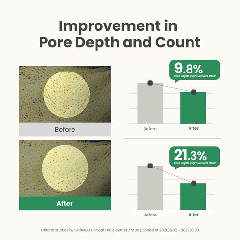 AXIS - Y Mugwort Pore Clarifying Wash Off Mask – Deep Cleansing Clay Mask with Mugwort for Sensitive & Acne-Prone Skin