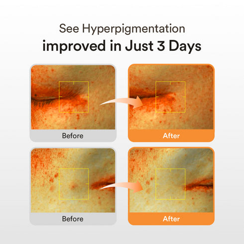 Abib Glutathiosome Dark Spot Serum Vita Drop (50ml)