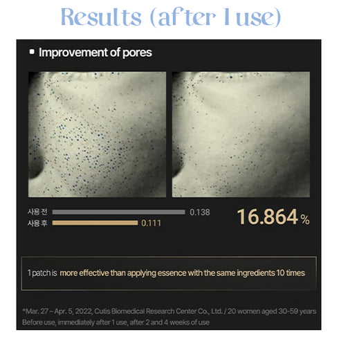 Acropass Retinol Microcone Wrinkle Patch (4 x 3 Patches)