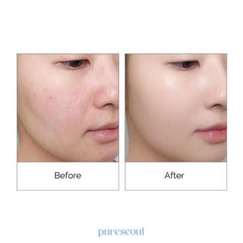 Athe Glazm Watering Cushion SPF50+ PA+++ - 2 Shades (14g)