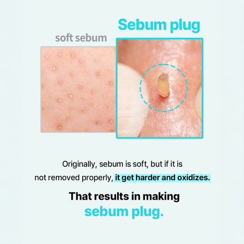 ilso Super Melting Sebum Softener (150g)