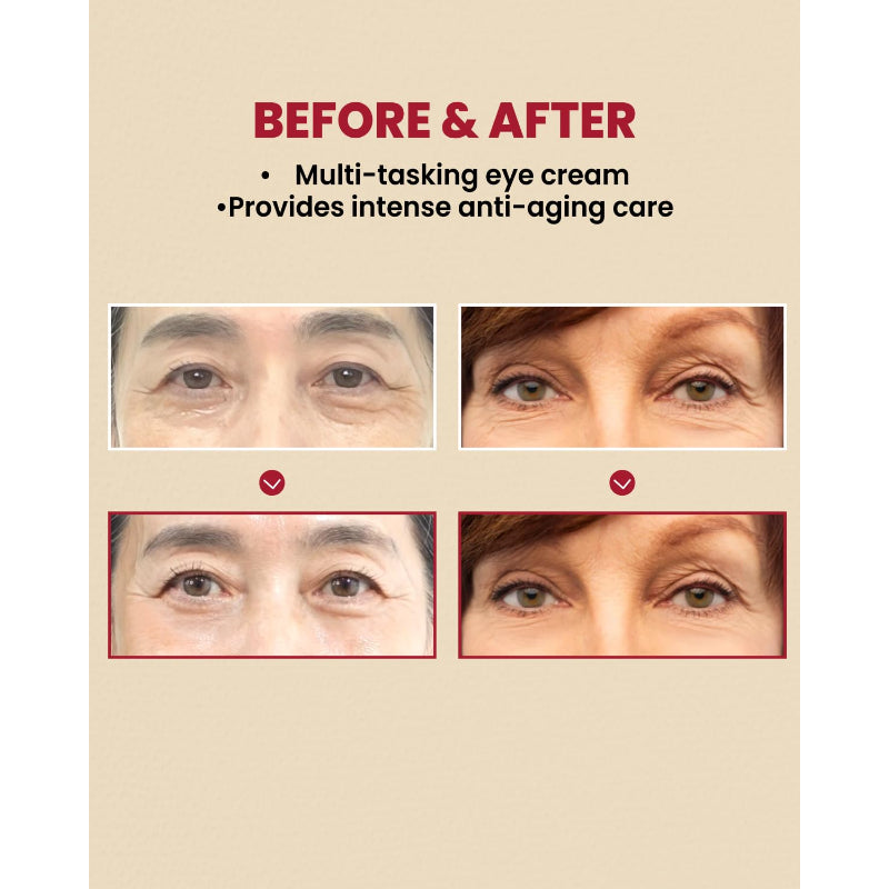 SEOUL 1988 Eye Cream : Retinal Liposome 4% + Fermented Bean, wrinkle care, anti-aging, skin elasticity, pigmentation, brightening