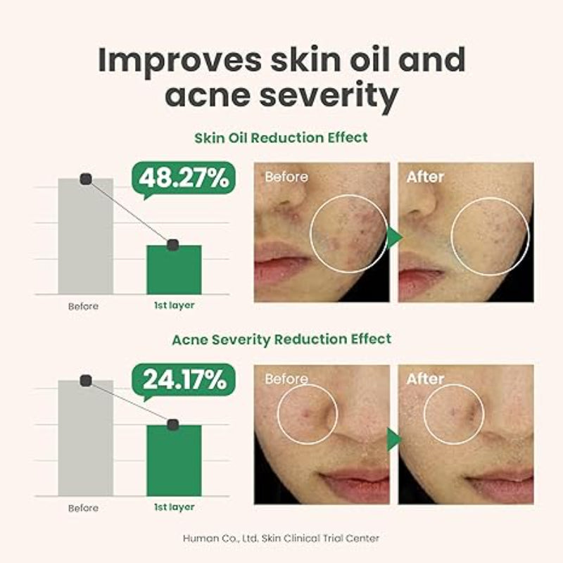 AXIS-Y Spot the Difference Blemish Treatment – Lightweight Serum for Acne-Prone & Sensitive Skin with Tea Tree & Zinc