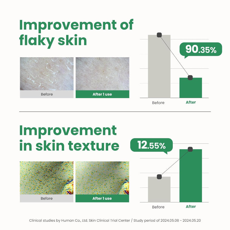 AXIS - Y PHA Resurfacing Glow Peel – Gentle Exfoliating Liquid with Polyhydroxy Acids for Radiant, Smooth Skin