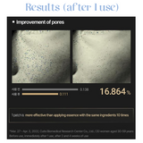 Acropass Retinol Microcone Wrinkle Patch (4 x 3 Patches)