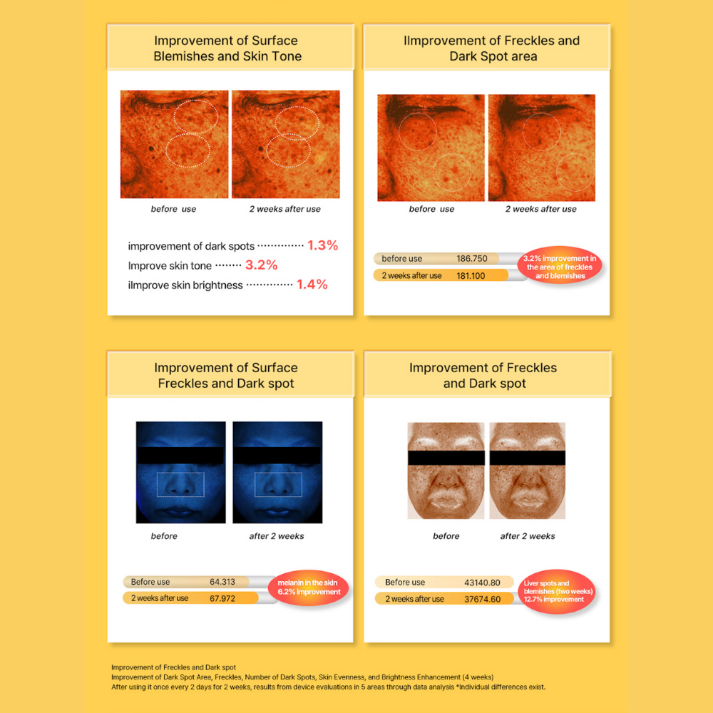 Acropass Spot Care, Dark Spot Eraser Microneedle Patches - 6 Pack