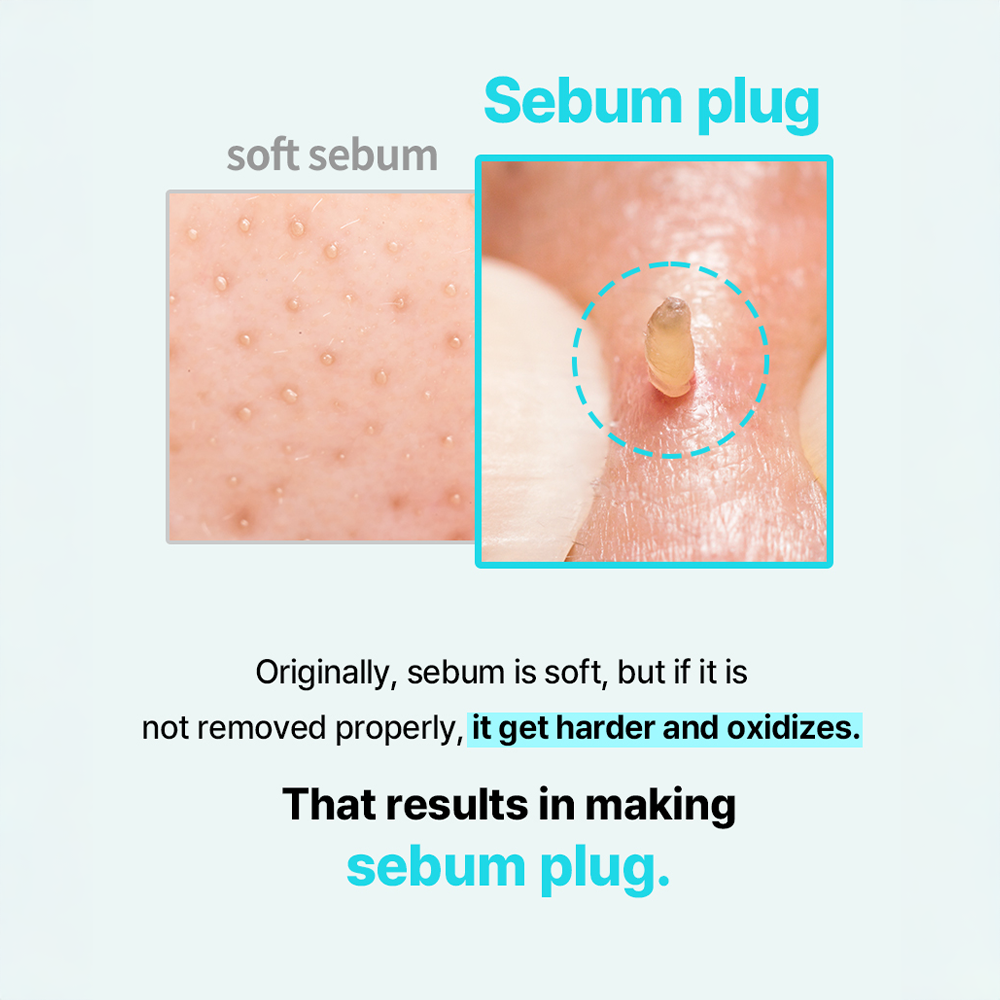 ilso Super Melting Sebum Softener (150g)