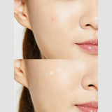 COSRX Acne Pimple Master Patch  Hydrocolloid Spot Treatment for Overnight Use  Blemish Cover Stickers for Whiteheads & Pimples